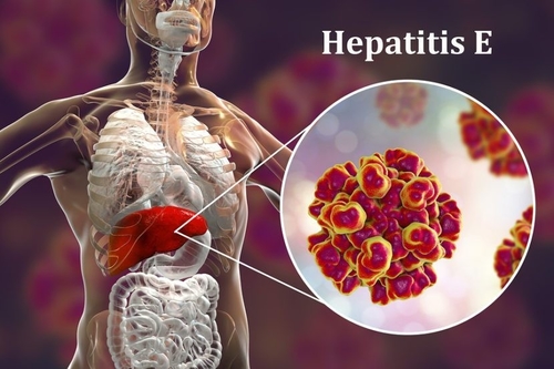 Şirketle ilgili en son haberler Virüslerle Reproduksiyon Tehlikesi: Hepatit E'nin Görünmeyen Tehlikeleri