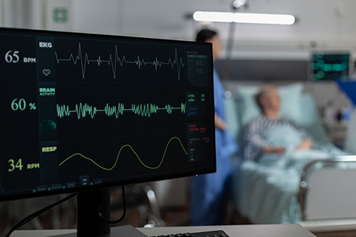 Son şirket blogları hakkında Atrial Fibrillation'ı (AFib) Anlamak